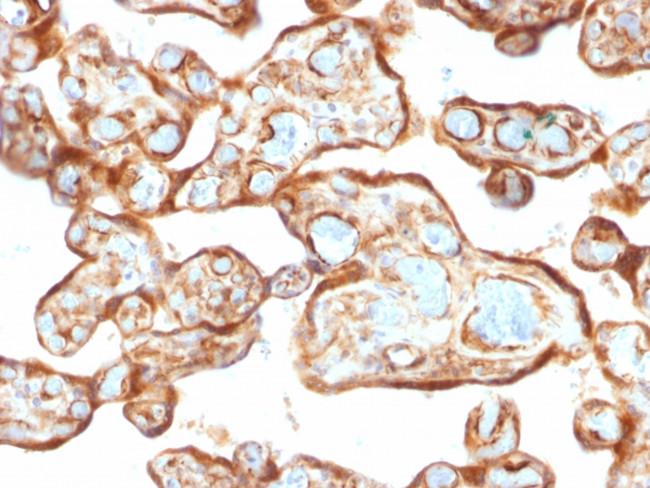 Thymidine Phosphorylase/PD-ECGF (Angiogenesis Marker) Antibody in Immunohistochemistry (Paraffin) (IHC (P))