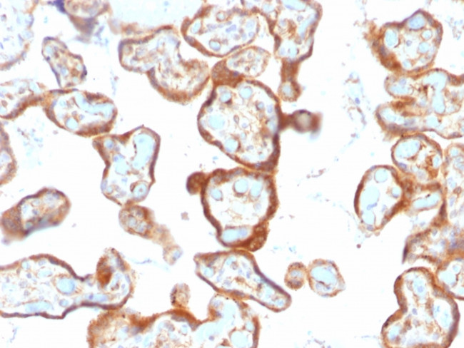 Thymidine Phosphorylase/PD-ECGF (Angiogenesis Marker) Antibody in Immunohistochemistry (Paraffin) (IHC (P))