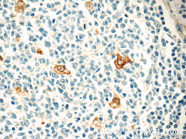 CLEC4D Antibody in Immunohistochemistry (Paraffin) (IHC (P))