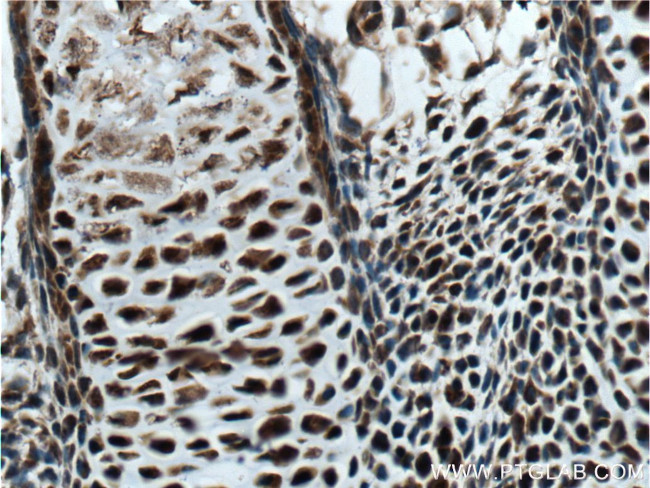 MYOD1 Antibody in Immunohistochemistry (Paraffin) (IHC (P))