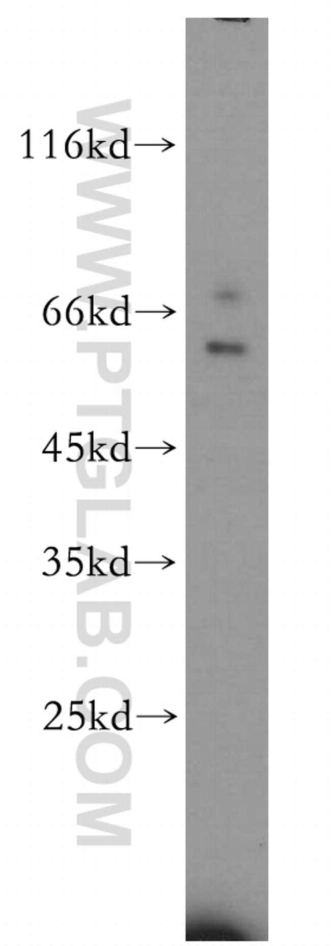 KIR2DL3 Antibody in Western Blot (WB)