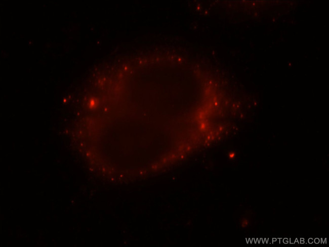 SH3PXD2A Antibody in Immunocytochemistry (ICC/IF)