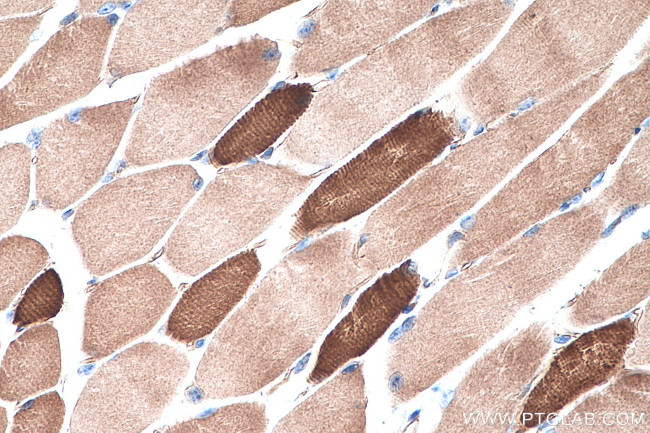 MYH8 Antibody in Immunohistochemistry (Paraffin) (IHC (P))