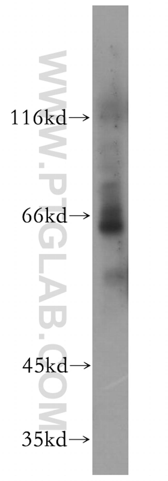 PIF1 Antibody in Western Blot (WB)