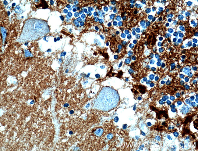 Brevican Antibody in Immunohistochemistry (Paraffin) (IHC (P))