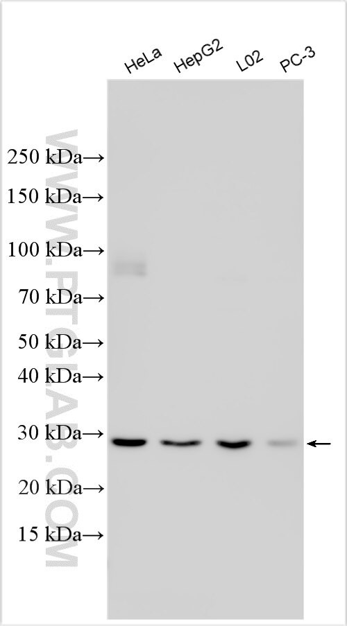 SNTB2 Antibody in Western Blot (WB)