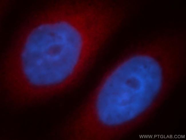 KLC1 Antibody in Immunocytochemistry (ICC/IF)
