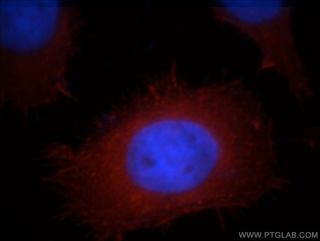 ACTN4 Antibody in Immunocytochemistry (ICC/IF)