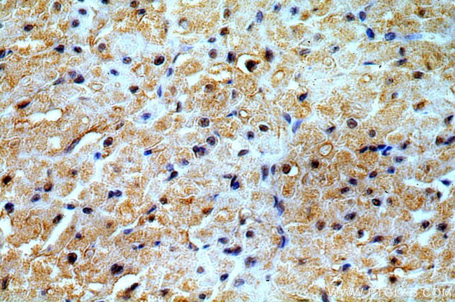 PRICKLE3 Antibody in Immunohistochemistry (Paraffin) (IHC (P))