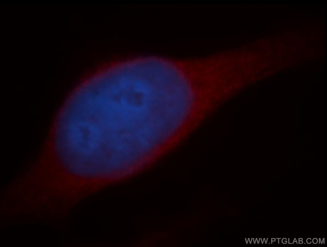 CYP2S1 Antibody in Immunocytochemistry (ICC/IF)