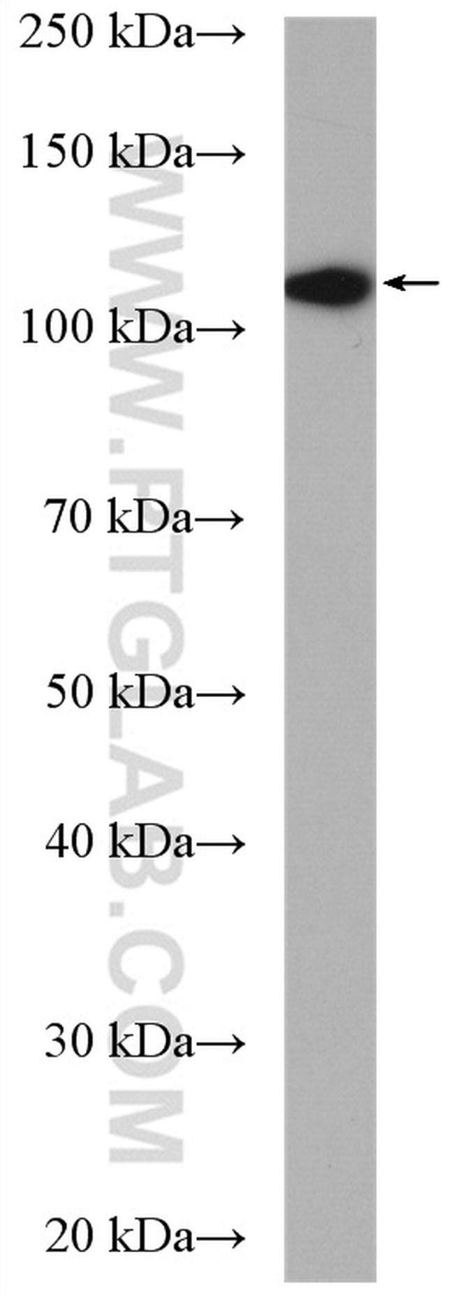EPAC2 Antibody in Western Blot (WB)