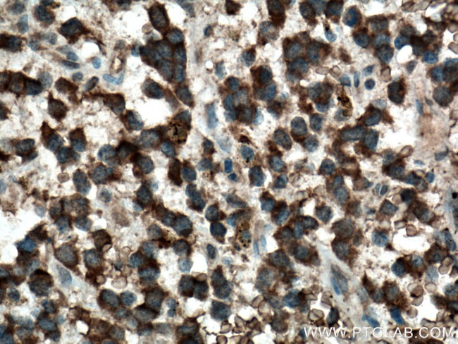 FOXO6 Antibody in Immunohistochemistry (Paraffin) (IHC (P))
