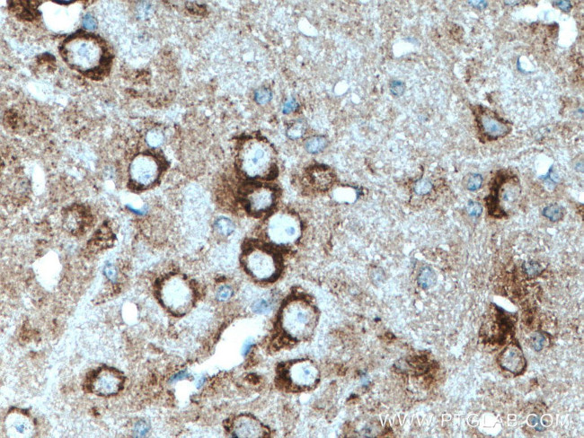 TRPA1 Antibody in Immunohistochemistry (Paraffin) (IHC (P))