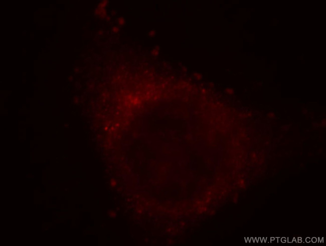 PLCH1 Antibody in Immunocytochemistry (ICC/IF)