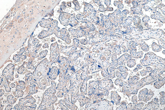 Tie2 Antibody in Immunohistochemistry (Paraffin) (IHC (P))