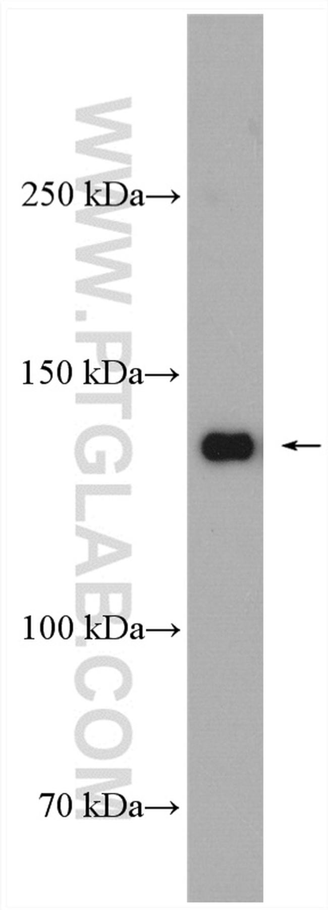 RFC1 Antibody in Western Blot (WB)