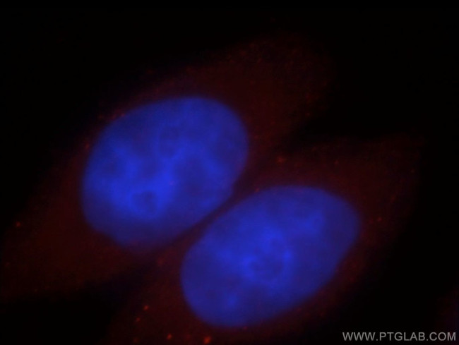 FKBP6 Antibody in Immunocytochemistry (ICC/IF)