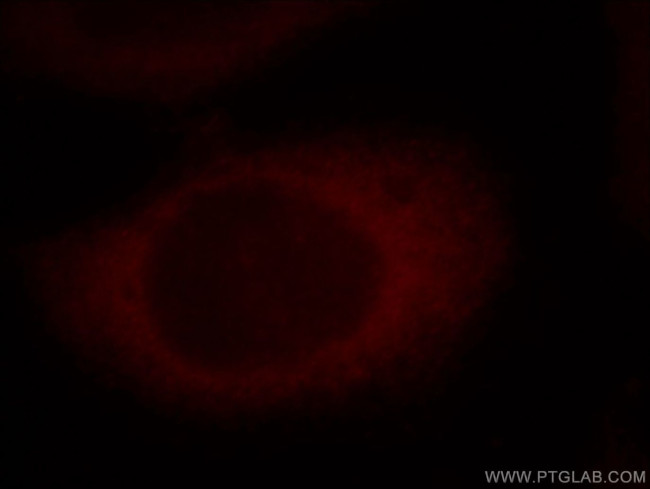 RAP1GAP Antibody in Immunocytochemistry (ICC/IF)