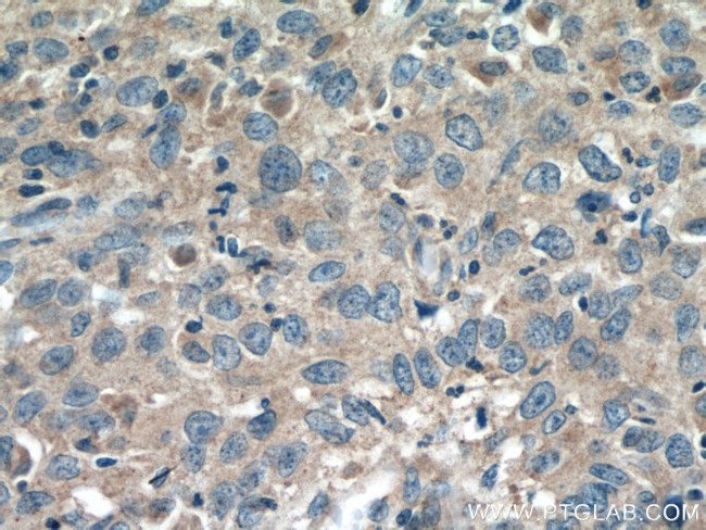 SFRP5 Antibody in Immunohistochemistry (Paraffin) (IHC (P))