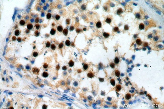 RUFY2 Antibody in Immunohistochemistry (Paraffin) (IHC (P))