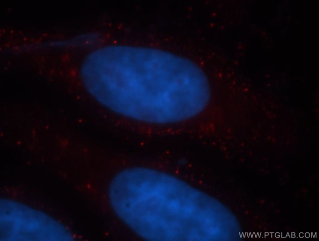 TMEM27 Antibody in Immunocytochemistry (ICC/IF)