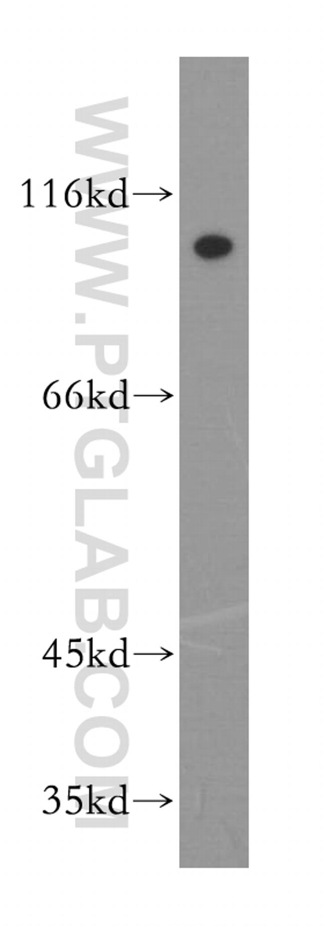 NUP107 Antibody in Western Blot (WB)