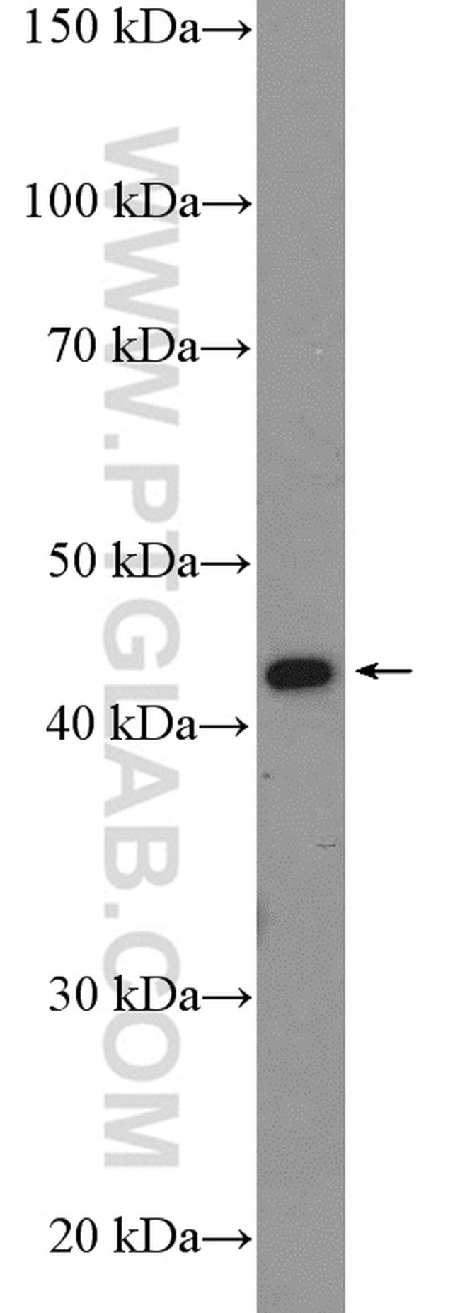 DNMT2 Antibody in Western Blot (WB)