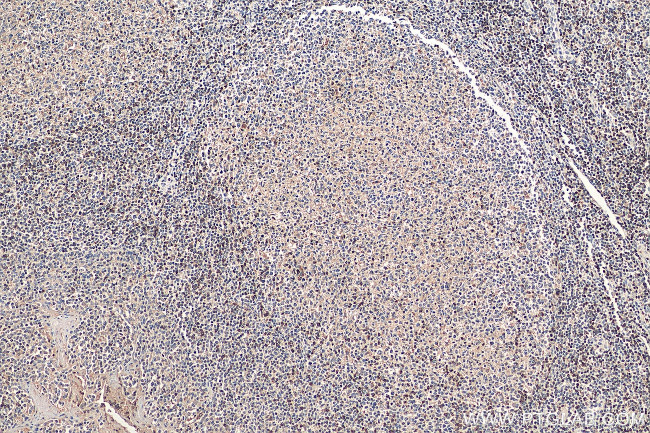 SKAP55 Antibody in Immunohistochemistry (Paraffin) (IHC (P))