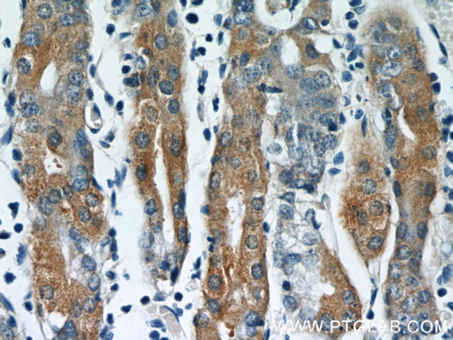 IFT122 Antibody in Immunohistochemistry (Paraffin) (IHC (P))