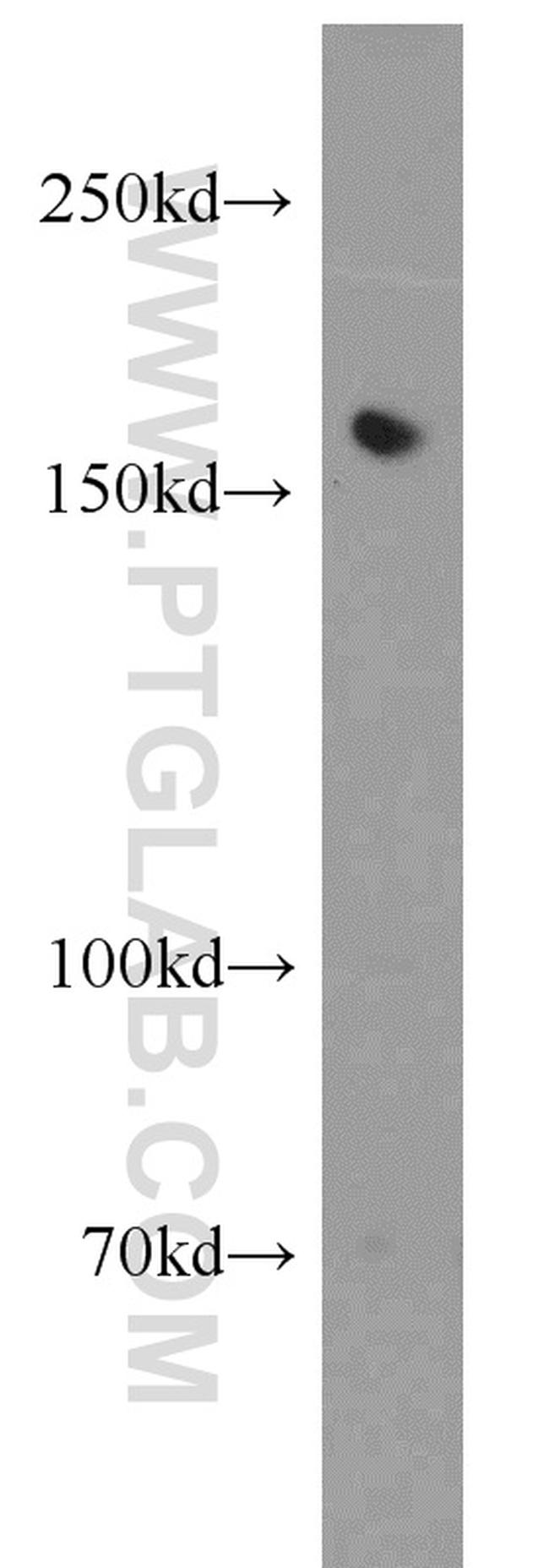 Tie1 Antibody in Western Blot (WB)