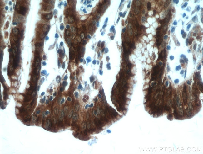 Gastrokine 1 Antibody in Immunohistochemistry (Paraffin) (IHC (P))