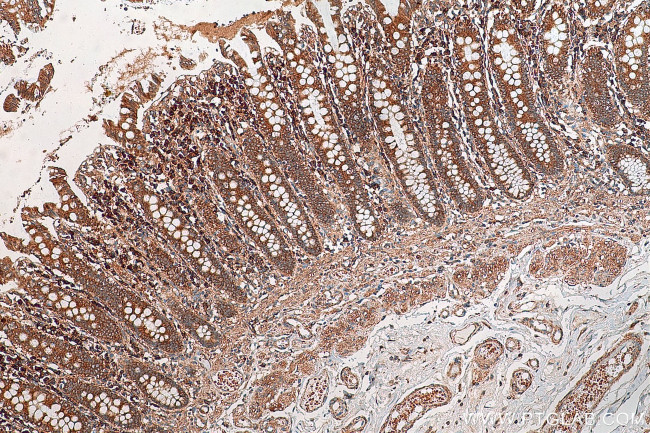 ADHFE1 Antibody in Immunohistochemistry (Paraffin) (IHC (P))