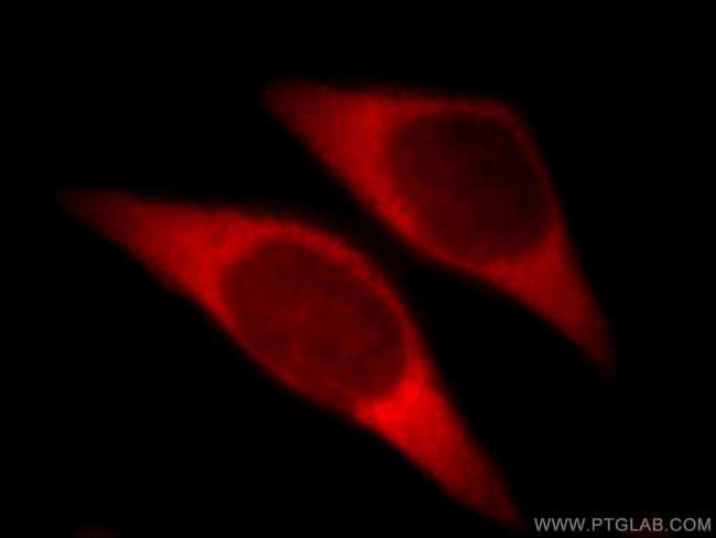 SLC25A20 Antibody in Immunocytochemistry (ICC/IF)