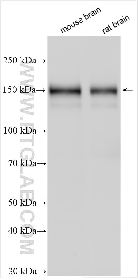 SEZ6L2 Antibody in Western Blot (WB)