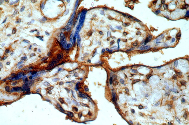 CCDC94 Antibody in Immunohistochemistry (Paraffin) (IHC (P))