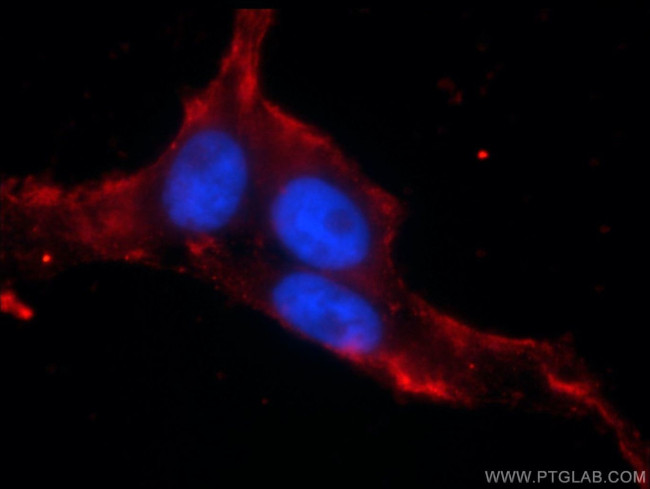 ANO8 Antibody in Immunocytochemistry (ICC/IF)