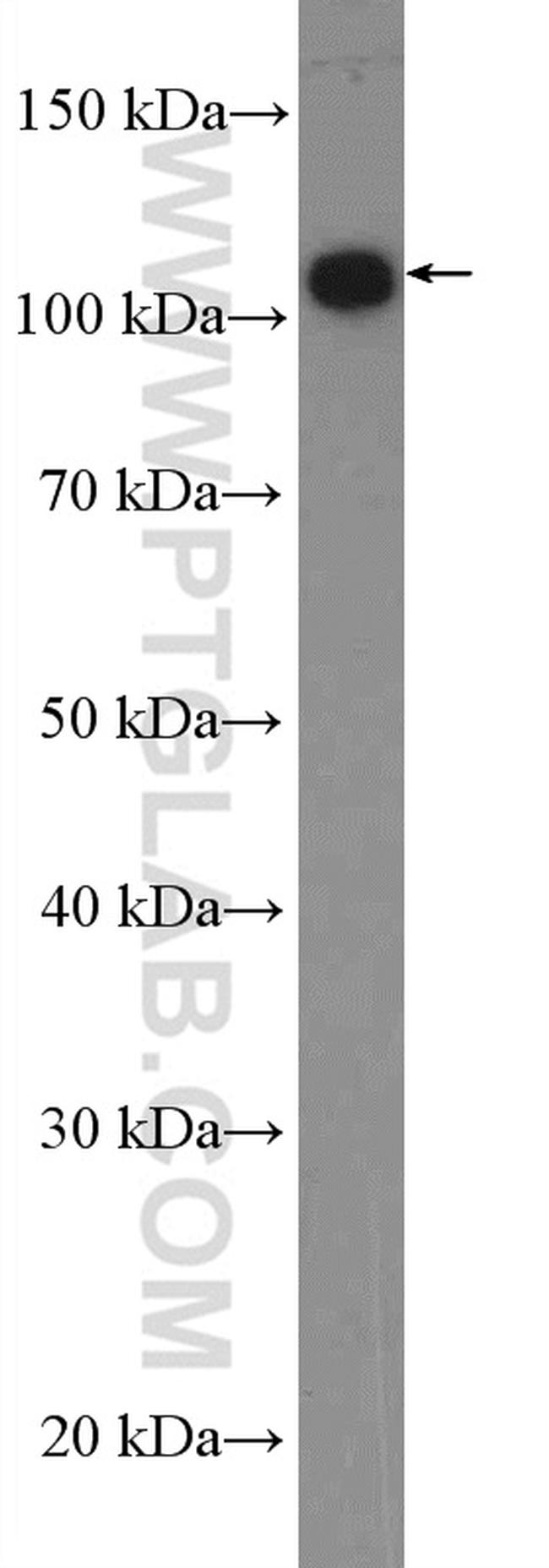 ANO7 Antibody in Western Blot (WB)