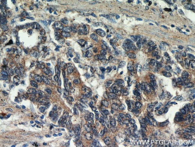 CEACAM3 Antibody in Immunohistochemistry (Paraffin) (IHC (P))