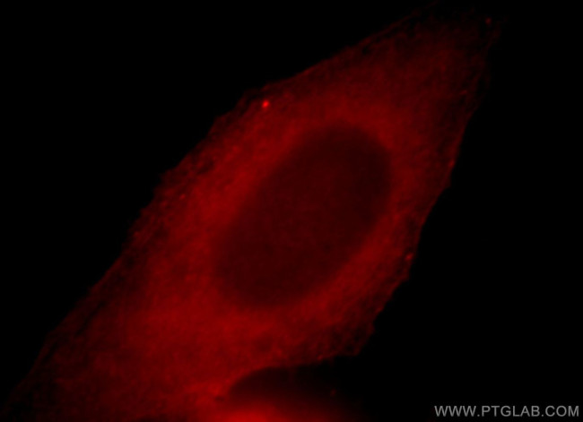 LRMP Antibody in Immunocytochemistry (ICC/IF)