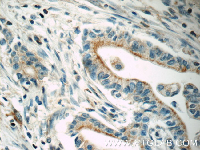 MRP5 Antibody in Immunohistochemistry (Paraffin) (IHC (P))
