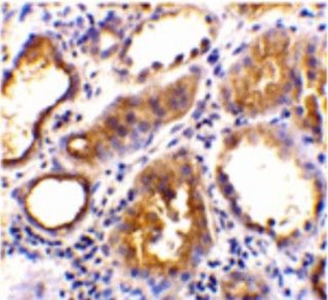 Angiotensin Converting Enzyme 2 (ACE2) Antibody in Immunohistochemistry (Paraffin) (IHC (P))