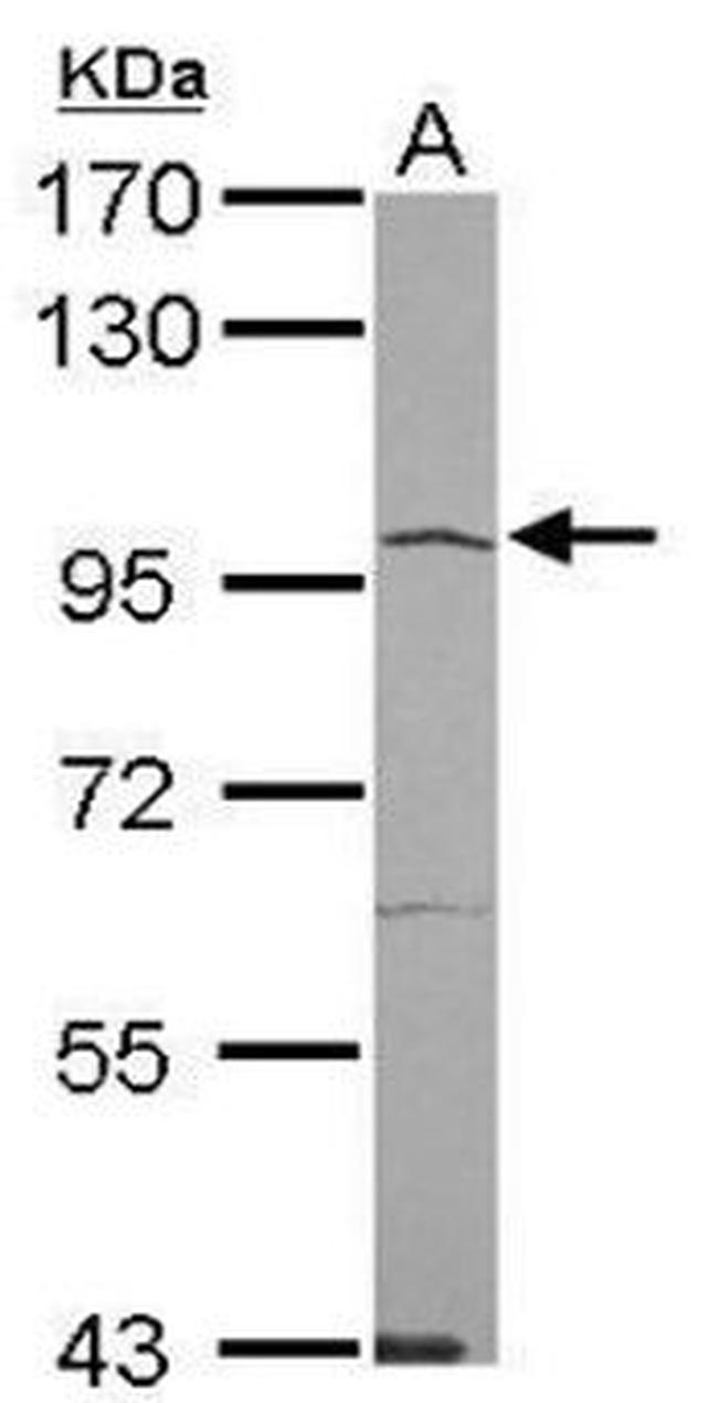Angiotensin Converting Enzyme 2 (ACE2) Antibody in Western Blot (WB)