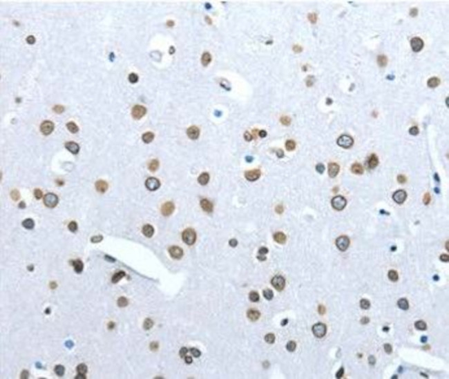 Angiotensin Converting Enzyme 2 (ACE2) Antibody in Immunohistochemistry (Paraffin) (IHC (P))