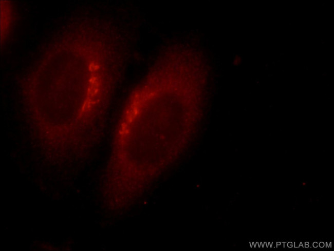 TOR2A Antibody in Immunocytochemistry (ICC/IF)