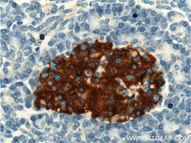 PRSS27 Antibody in Immunohistochemistry (Paraffin) (IHC (P))