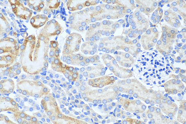 FAAH2 Antibody in Immunohistochemistry (Paraffin) (IHC (P))