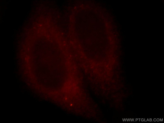 NY-ESO-1 Antibody in Immunocytochemistry (ICC/IF)
