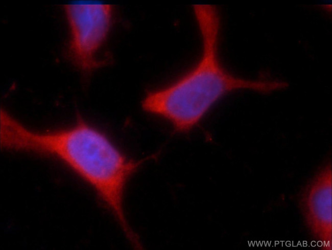 SPANXA2/SPANXA1 Antibody in Immunocytochemistry (ICC/IF)