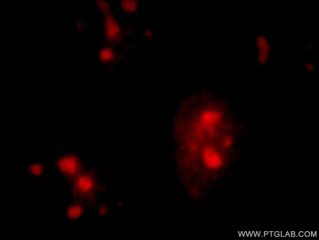 SPIN1 Antibody in Immunocytochemistry (ICC/IF)
