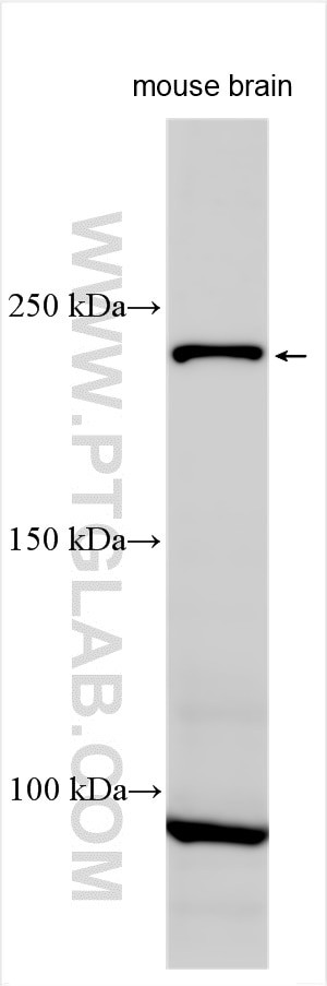 CACNA1I Antibody in Western Blot (WB)